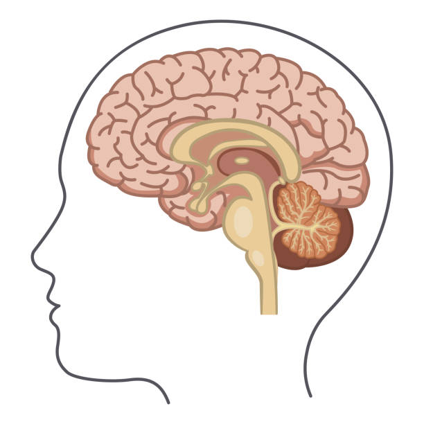 concussion